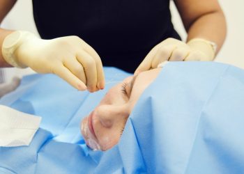 Silhouette Facelift Procedure